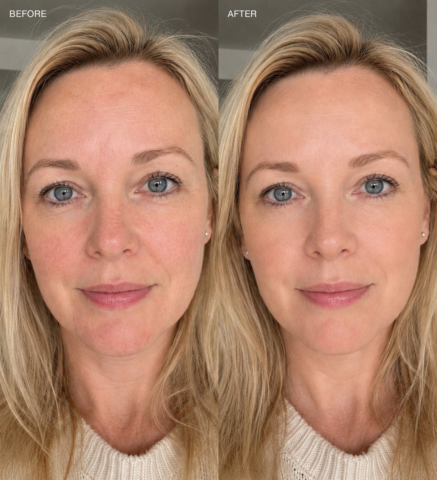 Before and after results using Changing Foundation to conceal redness and create an even complexion.